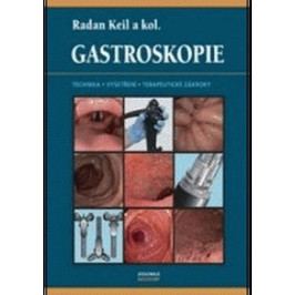 Keil Radan a kolektiv: Gastroskopie
